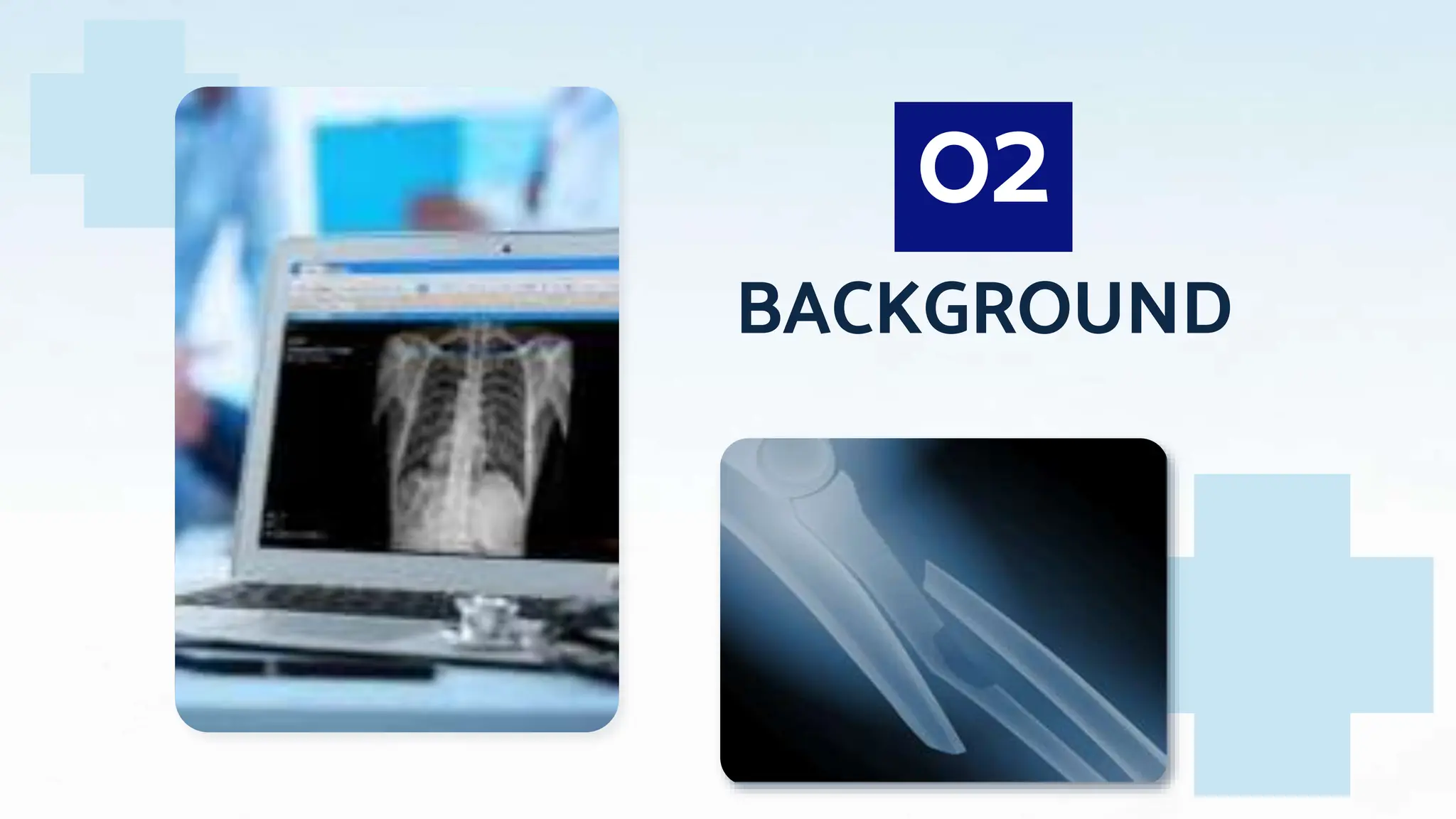 DIGITAL RADIOGRAPHY in X-RAY-1DIGITAL RADIOGRAPHY in X-RAY-1.pptx