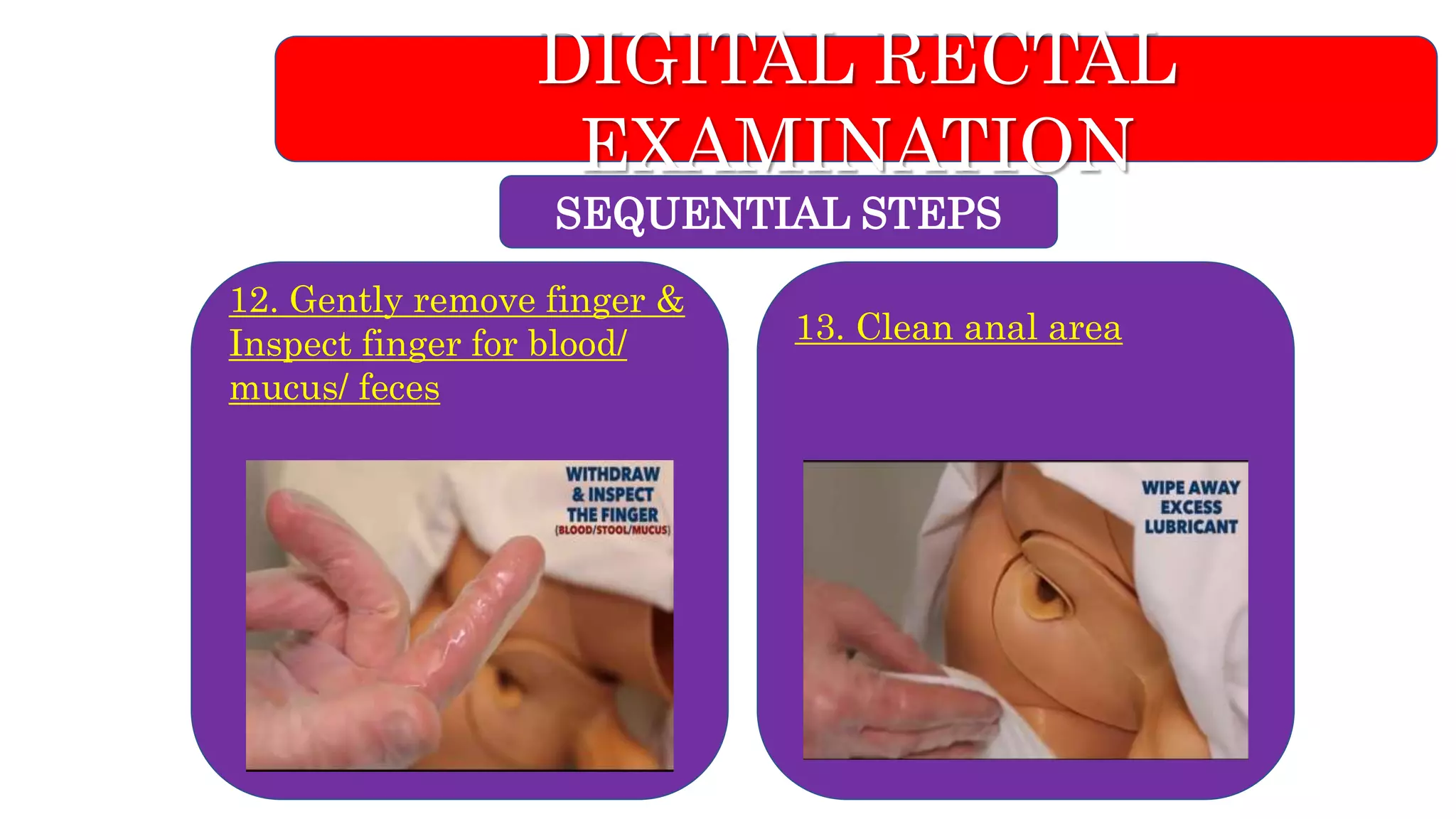Digital rectal examination/Skill lab/ OSCE | PPTX