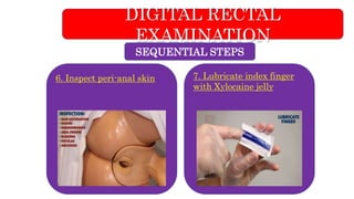 Digital rectal examination/Skill lab/ OSCE | PPTX