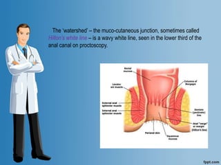 The ‘watershed’ – the muco-cutaneous junction, sometimes called
Hilton’s white line – is a wavy white line, seen in the lower third of the
anal canal on proctoscopy.
 