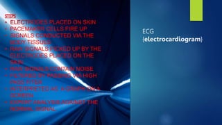 ECG
{electrocardiogram}
STEPS
• ELECTRODES PLACED ON SKIN
• PACEMAKER CELLS FIRE UP
• SIGNALS CONDUCTED VIA THE
BODY TISSUES
• RAW SIGNALS PICKED UP BY THE
ELECTRODES PLACED ON THE
SKIN
• RAW SIGNALS CONTAIN NOISE
• FILTERED BY PASSING VIA HIGH
PASS FITER
• INTERPRETED AS A GRAPH ON A
SCREEN
• EXPERT ANALYSIS AGAINST THE
NORMAL SIGNAL.
 