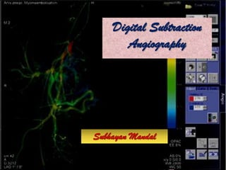 Free Powerpoint Templates Page 1
Digital Subtraction
Angiography
Subhayan Mandal
 