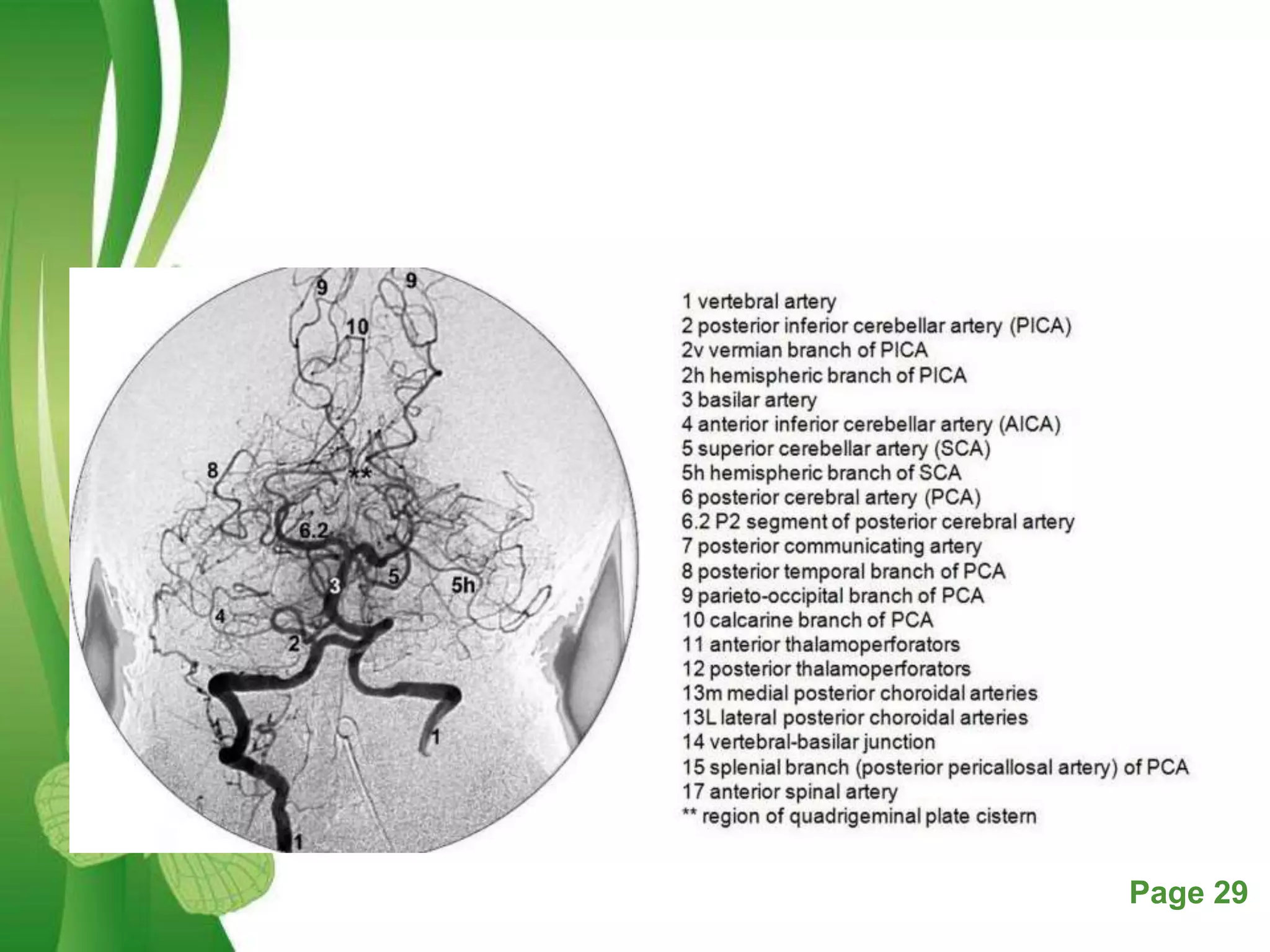 Dsa Radiology Digital subtraction angiography | PPTX