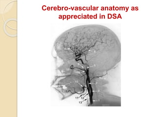 Cerebro-vascular anatomy as
appreciated in DSA
 