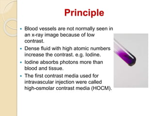 Principle
 Blood vessels are not normally seen in
an x-ray image because of low
contrast.
 Dense fluid with high atomic numbers
increase the contrast. e.g. Iodine.
 Iodine absorbs photons more than
blood and tissue.
 The first contrast media used for
intravascular injection were called
high-osmolar contrast media (HOCM).
 