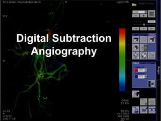 Digital Subtraction
Angiography
 
