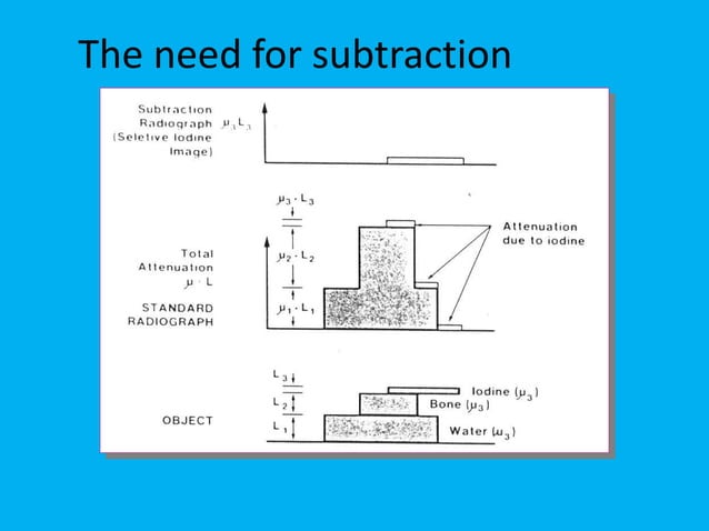 Substraction Radiograph Unit Digital Subtraction Angiography king saud unversity.pdf
