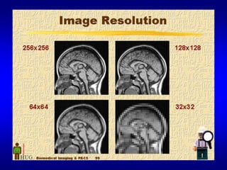 Digital Techniques For Myocardial Perfusion Spect