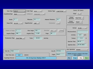 Digital Techniques For Myocardial Perfusion Spect