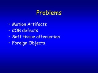 Problems
?   Motion Artifacts
?   COR defects
?   Soft tissue attenuation
?   Foreign Objects
 