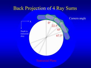 Back Projection of 4 Ray Sums
                                             Camera angle
                x
                             0
                                  22.5
   Depth in
                                      45
   transaxial
   slice                             67.5




                    Transaxial Plane
 