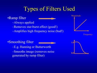 Types of Filters Used
                                            Magnitude
?Ramp filter
   CAlways applied
   CRemoves star-burst effect (good!)
   CAmplifies high frequency noise (bad!)
                                                        Frequency


?Smoothing filter                           1.0

   CE.g. Hanning or Butterworth
   CSmooths image (removes noise            0.0
   generated by ramp filter)
 