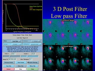 3 D Post Filter
Low pass Filter
 