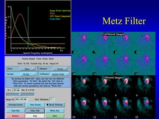 Metz Filter
 