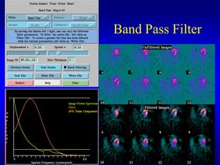 Band Pass Filter
 