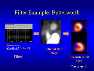 Filter Example: Butterworth




Butterworth
[Cutoff = 0.3 Order =5]   Filtered Raw
                              image
       Filter                            Reconstructed
                                             slice
                                         Too smooth!
 