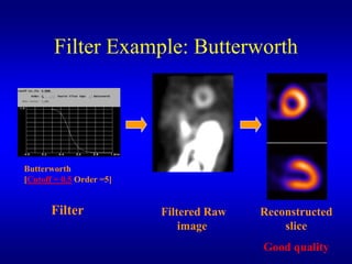 Filter Example: Butterworth




Butterworth
[Cutoff = 0.5 Order =5]


       Filter             Filtered Raw   Reconstructed
                              image          slice
                                         Good quality
 