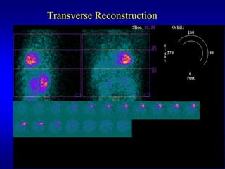 Transverse Reconstruction
 