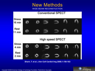 New Methods
                                                  WIDE BEAM RECONSTUCTION




                                     Sharir, T. et al. J Am Coll Cardiol Img 2008;1:156-163



Copyright ?2008 American College of Cardiology Foundation. Restrictions may apply.
 