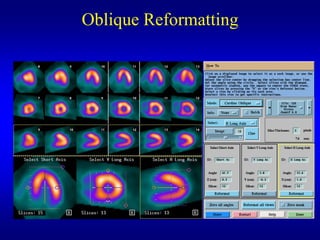 Oblique Reformatting
 