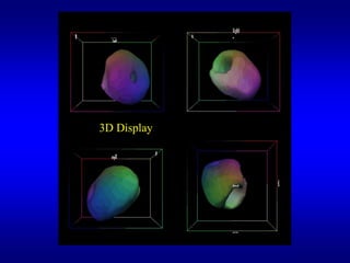 3D Display
 