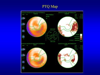PTQ Map
 