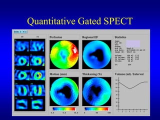 Quantitative Gated SPECT
 