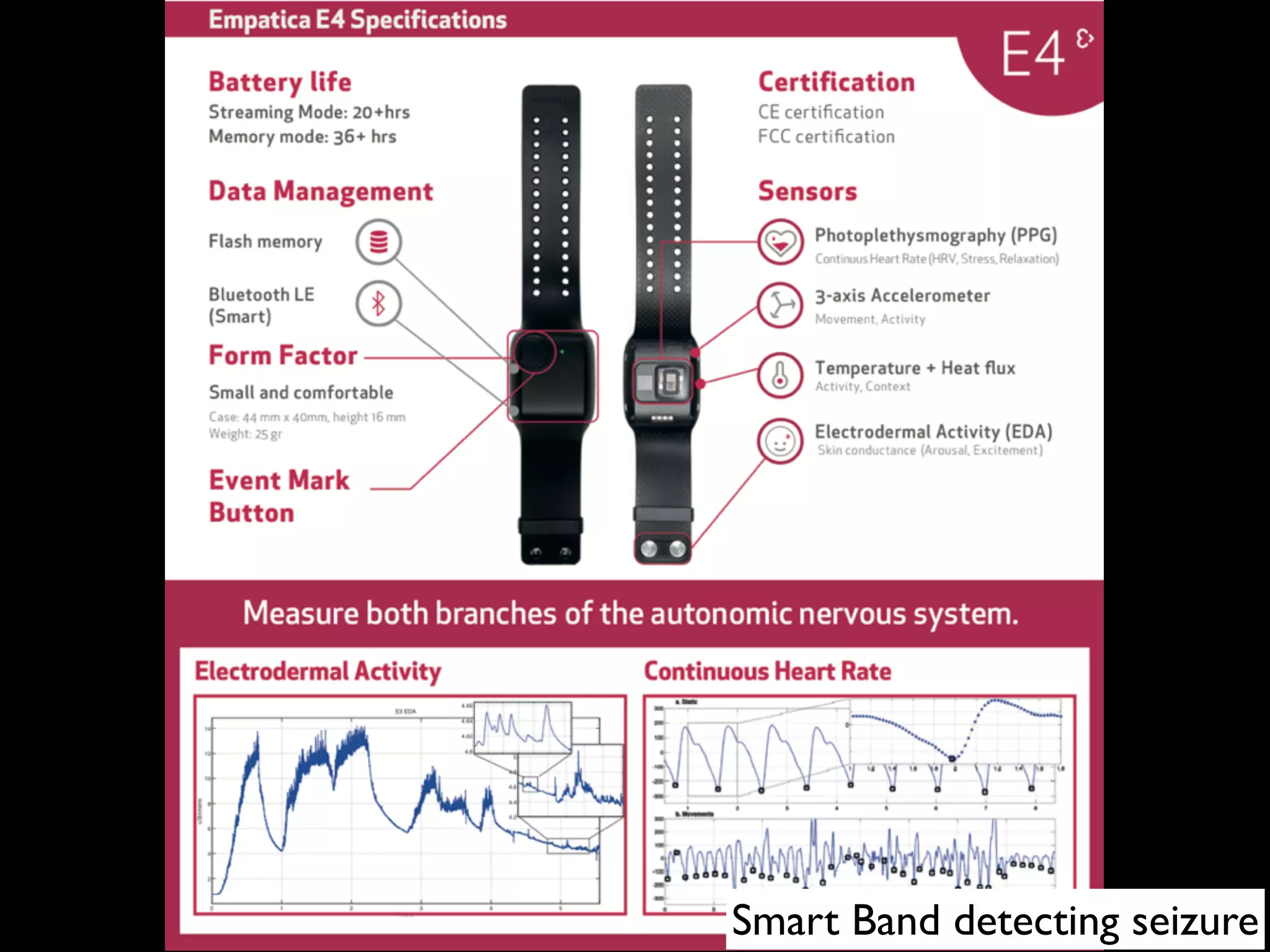 Smart Band detecting seizure
 