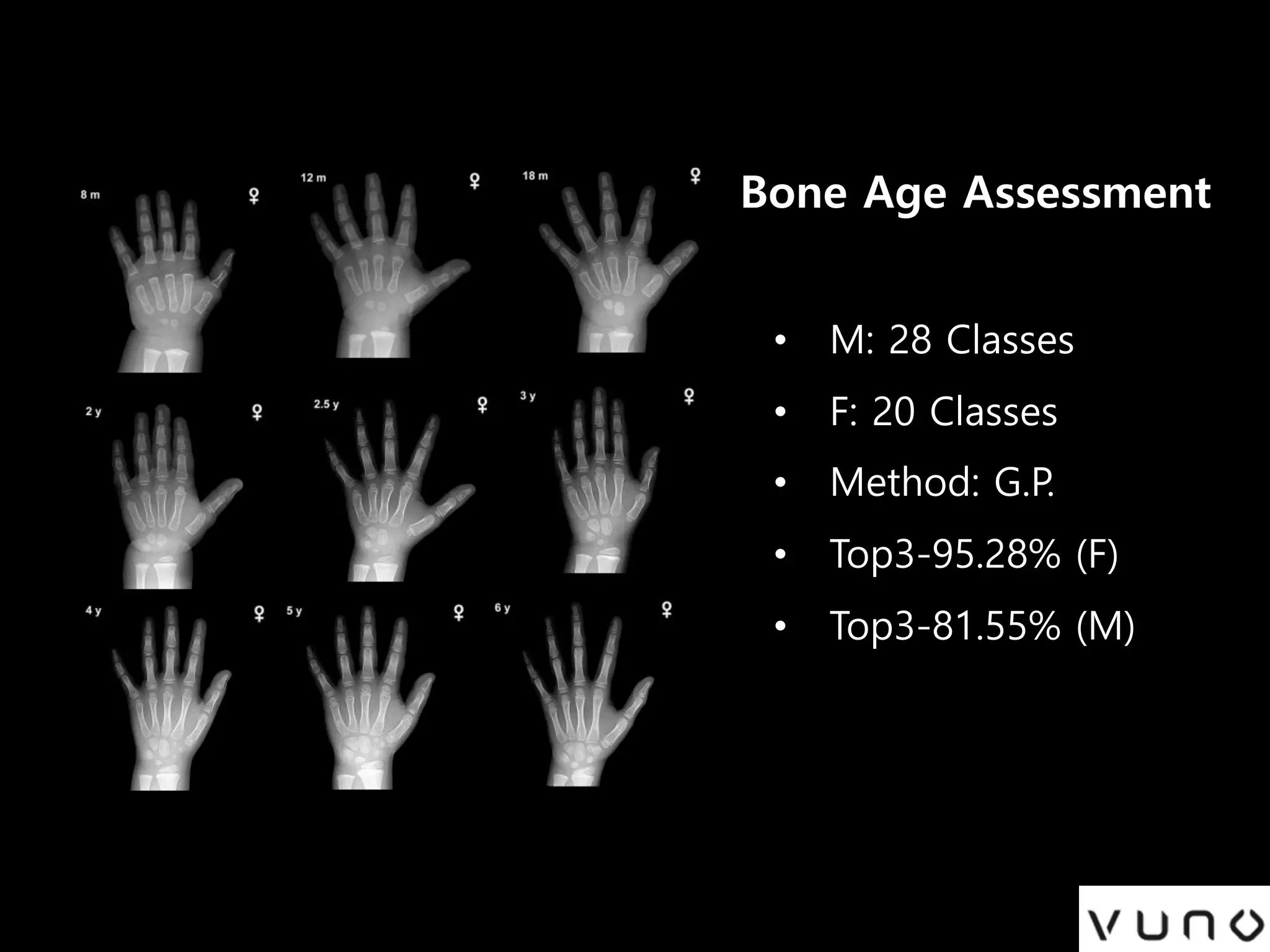 Bone Age Assessment
• M: 28 Classes
• F: 20 Classes
• Method: G.P.
• Top3-95.28% (F)
• Top3-81.55% (M)
 