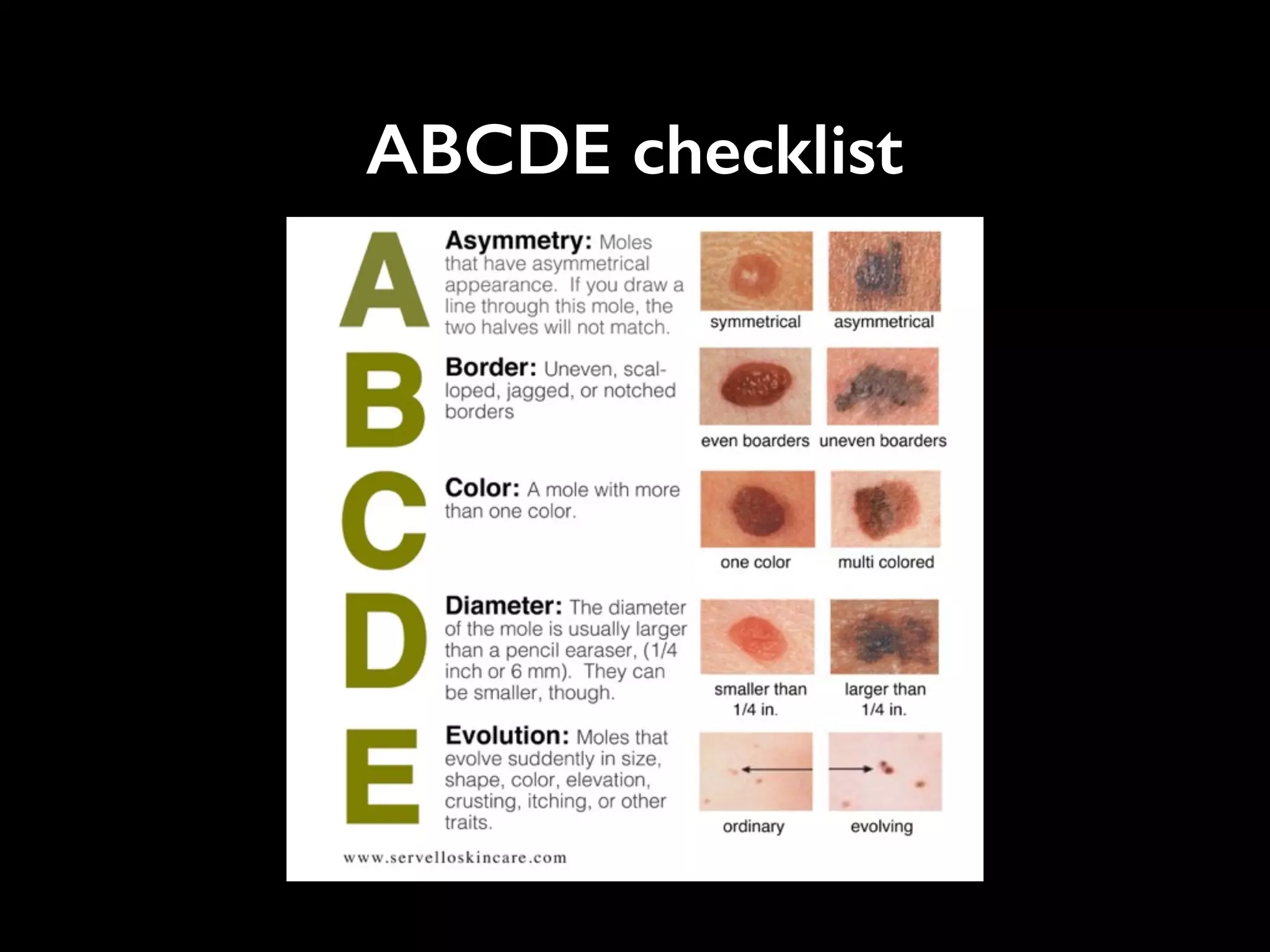 ABCDE checklist
 