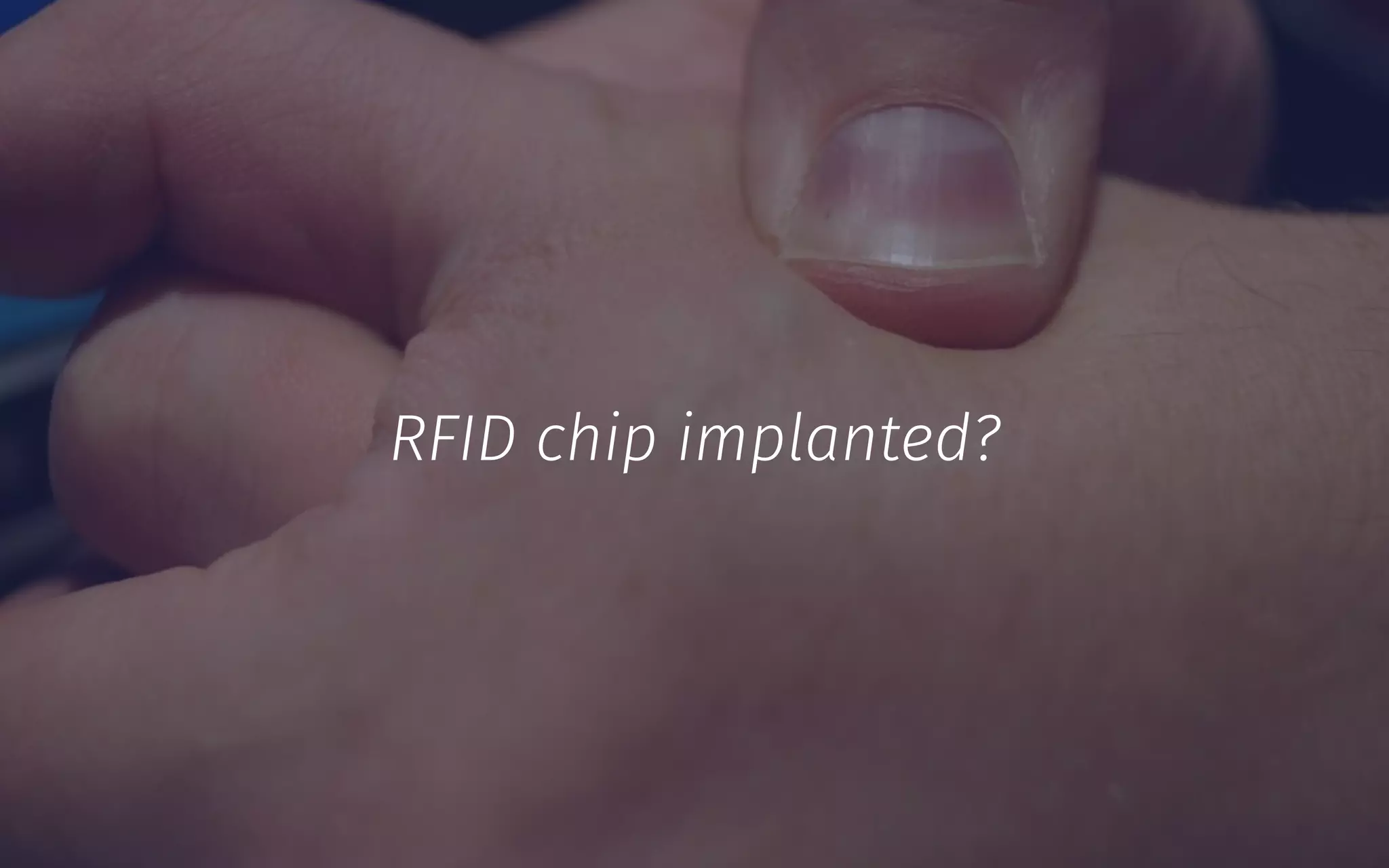 RFID chip implanted?
 