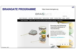 | 37
© Numenor, 2021
BRAINGATE PROGRAMME https://www.braingate.org
 