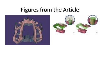 Digital_Workflow_RPD_with_Biomechanics_and_Force_Diagram.pptx