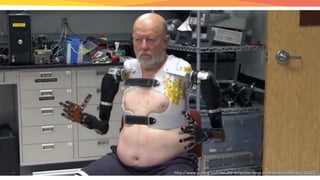 http://www.gizmag.com/double-amputee-mind-controlled-prosthetics/35321/http://www.gizmag.com/double-amputee-mind-controlled-prosthetics/35321/
 