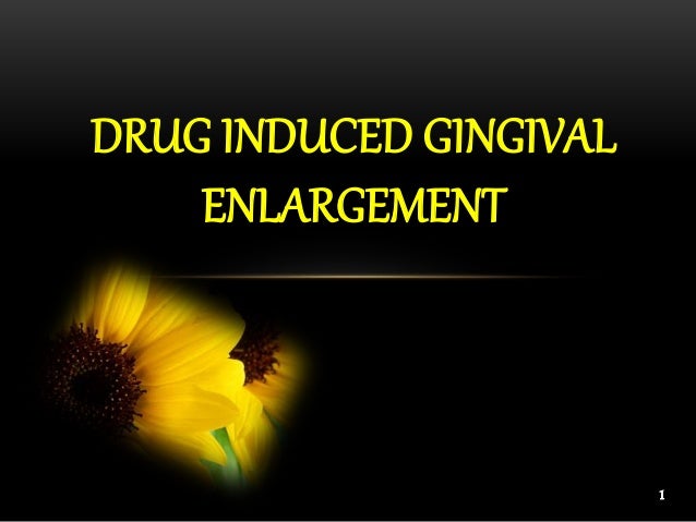 DRUG INDUCED GINGIVAL
ENLARGEMENT
1
 