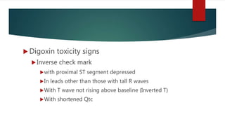  Digoxin toxicity signs
Inverse check mark
with proximal ST segment depressed
In leads other than those with tall R waves
With T wave not rising above baseline (Inverted T)
With shortened Qtc
 