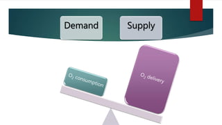 Demand Supply
 