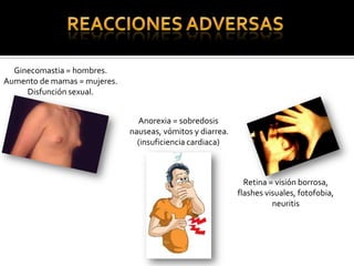 Ginecomastia = hombres.
Aumento de mamas = mujeres.
Disfunción sexual.
Anorexia = sobredosis
nauseas, vómitos y diarrea.
(insuficiencia cardiaca)
Retina = visión borrosa,
flashes visuales, fotofobia,
neuritis
 