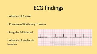 ECG findings
• Absence of P wave
• Presence of fibrillatory ‘f’ waves
• Irregular R-R interval
• Absence of isoelectric
baseline
 