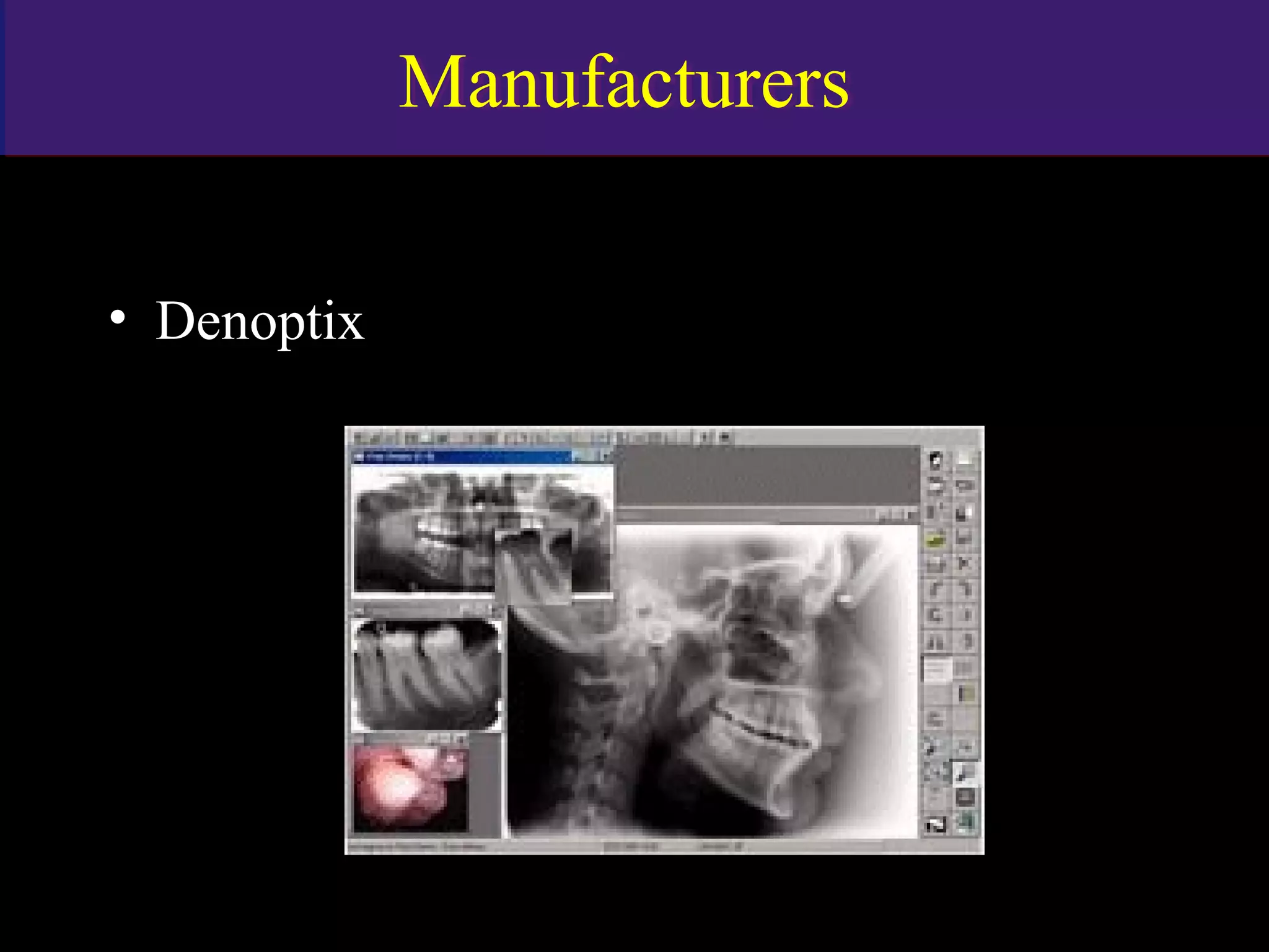 ManufacturersManufacturers
• Denoptix
www.indiandentalacademy.com
 