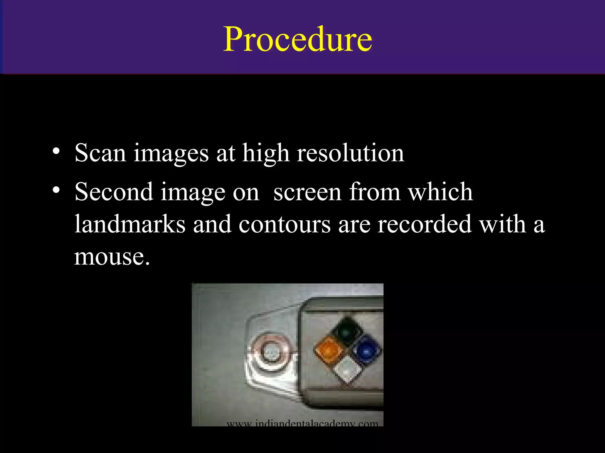 ProcedureProcedure
• Scan images at high resolution
• Second image on screen from which
landmarks and contours are recorded with a
mouse.
www.indiandentalacademy.com
 
