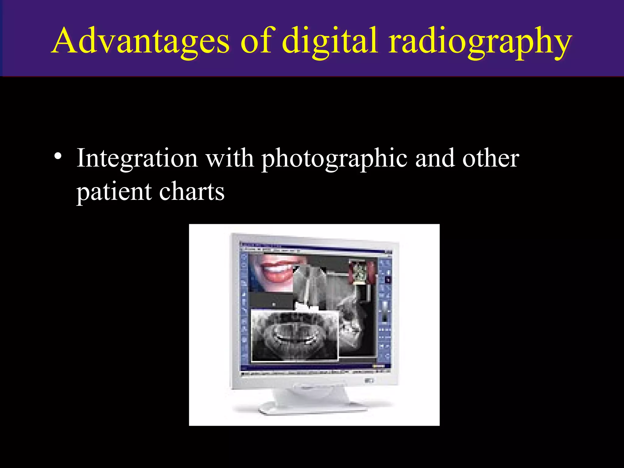 Advantages of digital radiographyAdvantages of digital radiography
• Integration with photographic and other
patient charts
www.indiandentalacademy.com
 