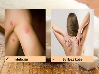 

Infekcije



Svrbež kože

 