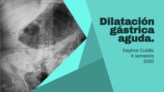 Dilatación
gástrica
aguda.
Daphne Cubilla
X semestre
2020
 