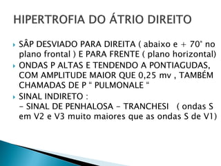    SÂP DESVIADO PARA DIREITA ( abaixo e + 70° no
    plano frontal ) E PARA FRENTE ( plano horizontal)
   ONDAS P ALTAS E TENDENDO A PONTIAGUDAS,
    COM AMPLITUDE MAIOR QUE 0,25 mv , TAMBÉM
    CHAMADAS DE P “ PULMONALE “
   SINAL INDIRETO :
    - SINAL DE PENHALOSA - TRANCHESI ( ondas S
    em V2 e V3 muito maiores que as ondas S de V1)
 