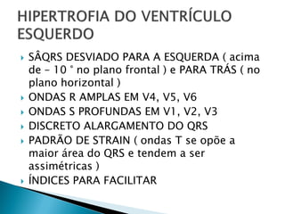    SÂQRS DESVIADO PARA A ESQUERDA ( acima
    de – 10 ° no plano frontal ) e PARA TRÁS ( no
    plano horizontal )
   ONDAS R AMPLAS EM V4, V5, V6
   ONDAS S PROFUNDAS EM V1, V2, V3
   DISCRETO ALARGAMENTO DO QRS
   PADRÃO DE STRAIN ( ondas T se opõe a
    maior área do QRS e tendem a ser
    assimétricas )
   ÍNDICES PARA FACILITAR
 