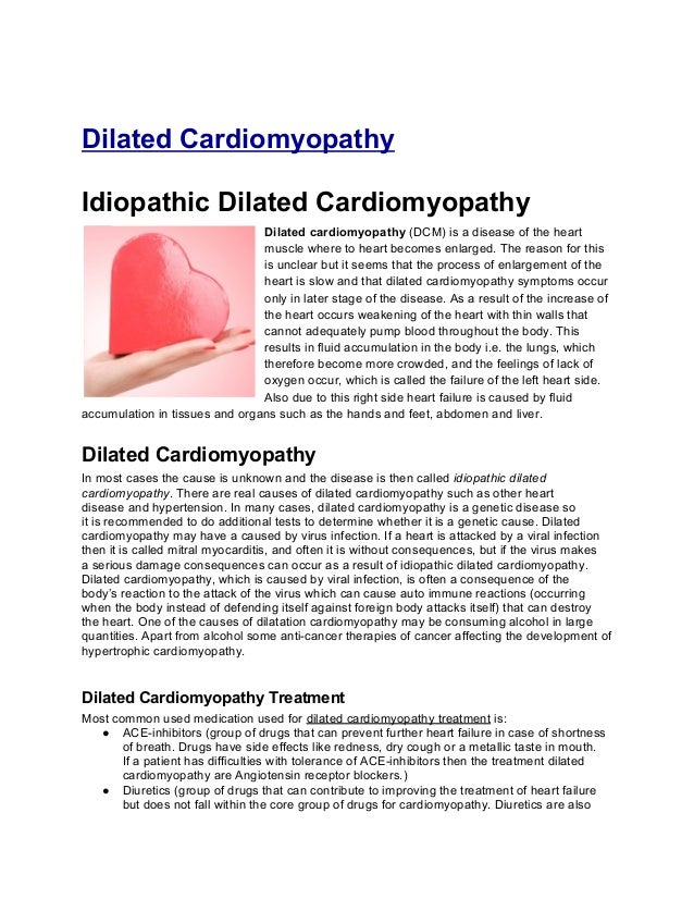 Dilated cardiomyopathy