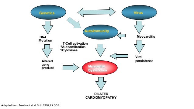 Dilated cardiomyopathy