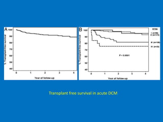 Transplant free survival in acute DCM
 