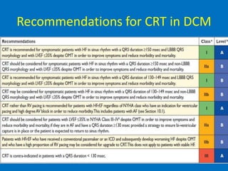 Recommendations for CRT in DCM
 